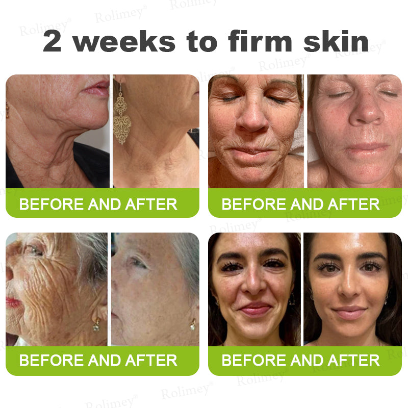 Rolimey®Wrinkle-Lift Tightening cream
