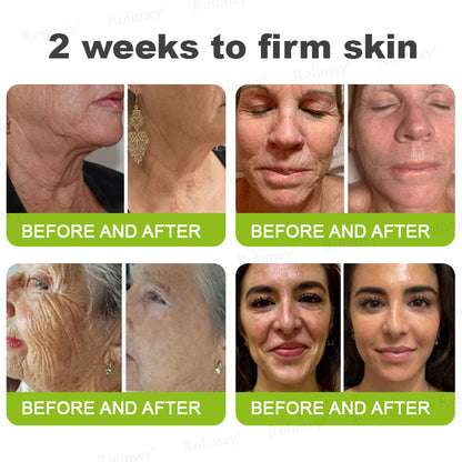 Rolimey®Wrinkle-Lift Tightening cream
