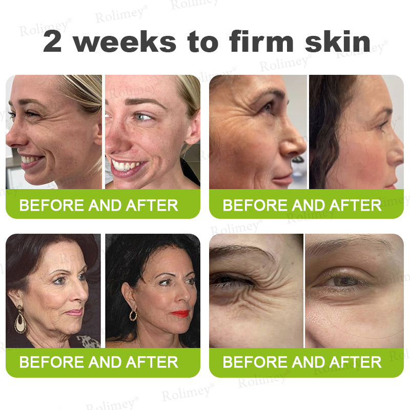 Rolimey®Wrinkle-Lift Tightening cream