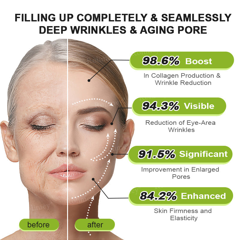 Rolimey®Wrinkle-Lift Tightening cream