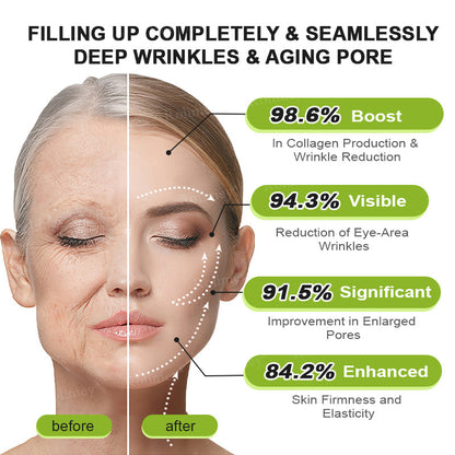 Rolimey®Wrinkle-Lift Tightening cream