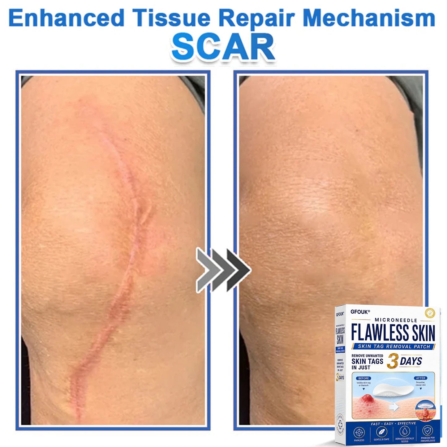🆕GFOUK® 2026 Newly Upgraded 2-in-1 Microneedle Hydrocolloid Patches | Removes Raised Moles, Acne, Flat Warts, and Skin Tags | Improves Wrinkles, Scars, and Blemishes | Invisible Acne Patches for Face & Body