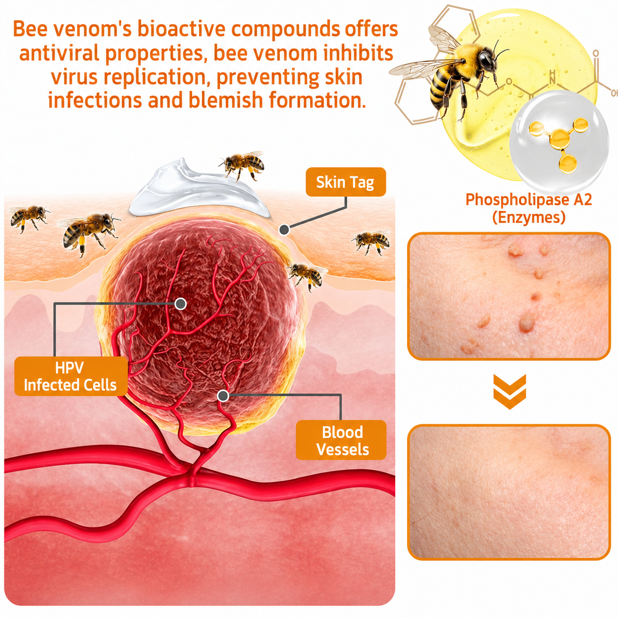 🔥Rolimey™ Bee Venom Skin Treatment Cream British Association of Dermatologists (BAD) Approved(Helping with acne, wart, rosacea, psoriasis, age spots, eczema, and reducing the appearance of stretch marks)🏵️