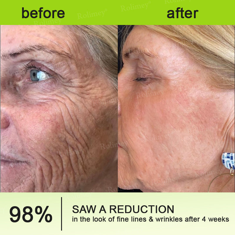 Rolimey®Wrinkle-Lift Tightening cream