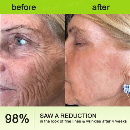 Rolimey®Wrinkle-Lift Tightening cream