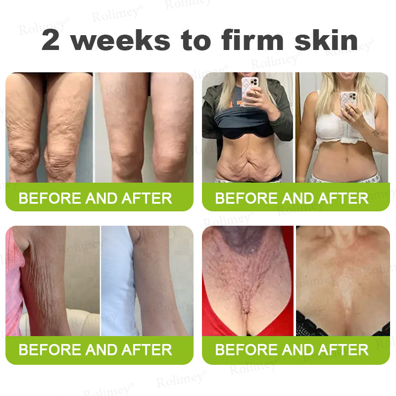 Rolimey®Wrinkle-Lift Tightening cream