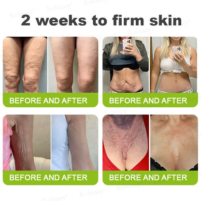 Rolimey®Wrinkle-Lift Tightening cream