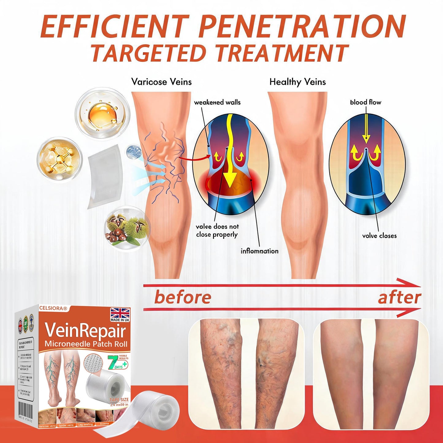 🧑‍⚕️🔥Celsiora® Vein Ease Microneedle Care Patch(For Spider Veins, Varicose Veins, Swelling & Leg Fatigue)