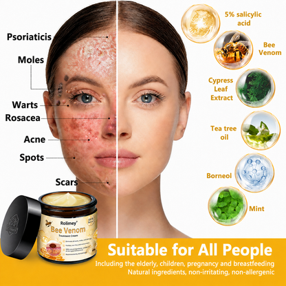 🔥Rolimey™ Bee Venom Skin Treatment Cream British Association of Dermatologists (BAD) Approved(Helping with acne, wart, rosacea, psoriasis, age spots, eczema, and reducing the appearance of stretch marks)🏵️
