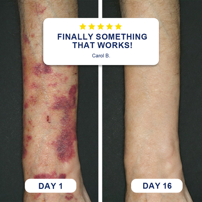 🗽Evolvion® Bruise Repair & Skin-Strengthening Cream