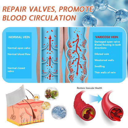 🧑‍⚕️🔥Celsiora® Vein Ease Microneedle Care Patch(For Spider Veins, Varicose Veins, Swelling & Leg Fatigue)