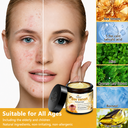🔥Rolimey™ Bee Venom Skin Treatment Cream British Association of Dermatologists (BAD) Approved(Helping with acne, wart, rosacea, psoriasis, age spots, eczema, and reducing the appearance of stretch marks)🏵️