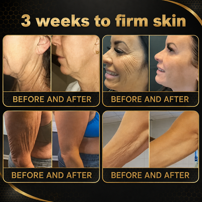 🔥Rolimey® Bee venom Pro Comprehensive Cream —Tightening for Skin Types 🔥