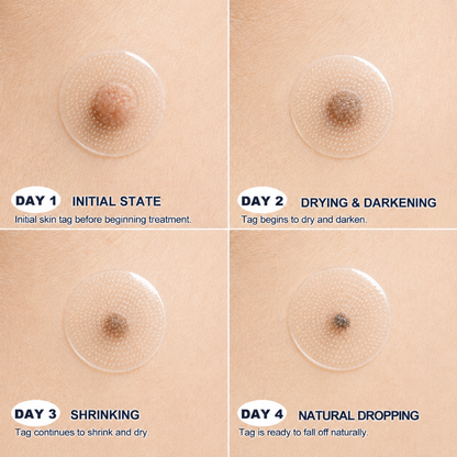 Enjoy 30% OFF for adding the second one👩‍⚕️