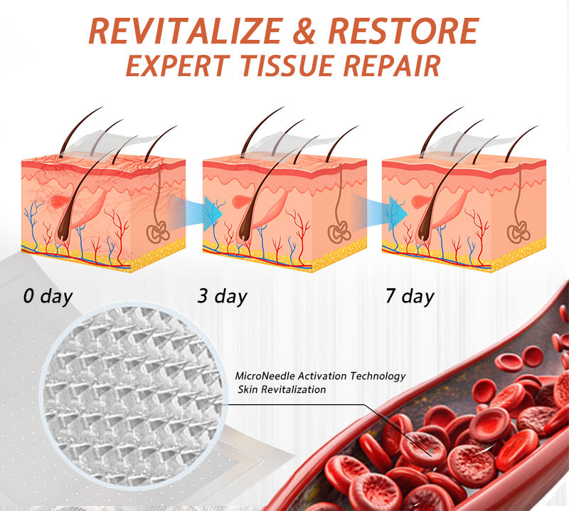 🧑‍⚕️🔥Celsiora® Vein Ease Microneedle Care Patch(For Spider Veins, Varicose Veins, Swelling & Leg Fatigue)