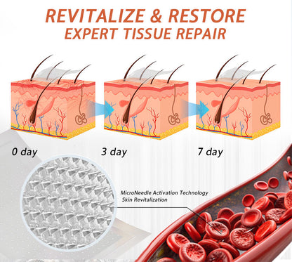 🧑‍⚕️🔥Celsiora® Vein Ease Microneedle Care Patch(For Spider Veins, Varicose Veins, Swelling & Leg Fatigue)
