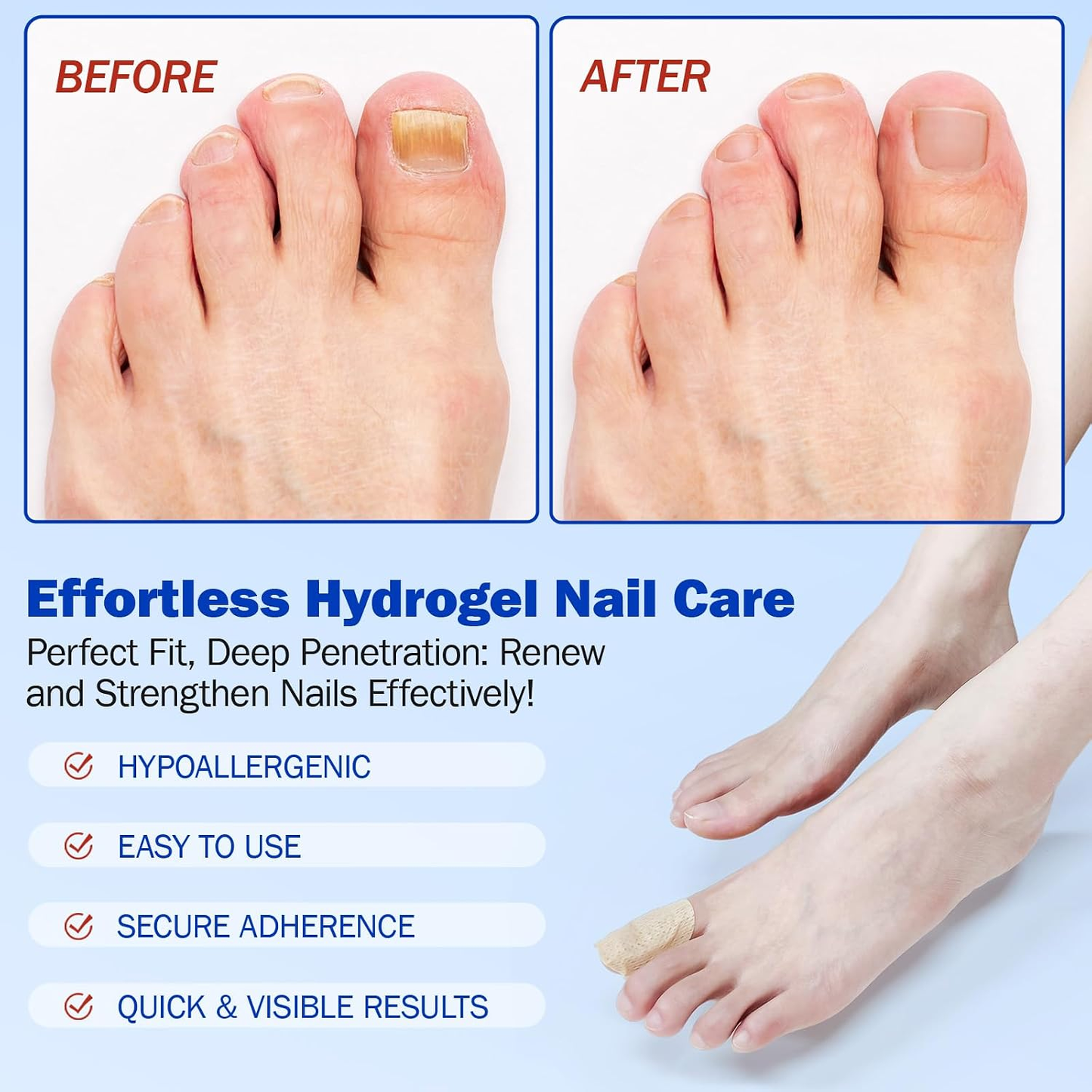 🔥Buy 1 Get 1  Free🔥21 Count/bag Nail Health Care Patches,Toenail Fungus Treatment Extra Strength