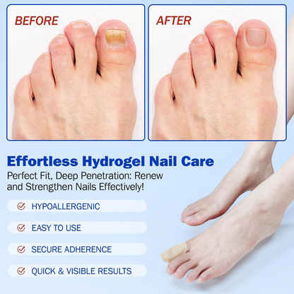 🔥Buy 1 Get 1  Free🔥21 Count/bag Nail Health Care Patches,Toenail Fungus Treatment Extra Strength