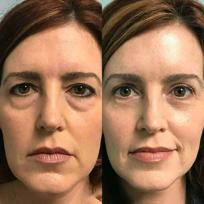 Rolimey®Wrinkle-Lift Tightening cream