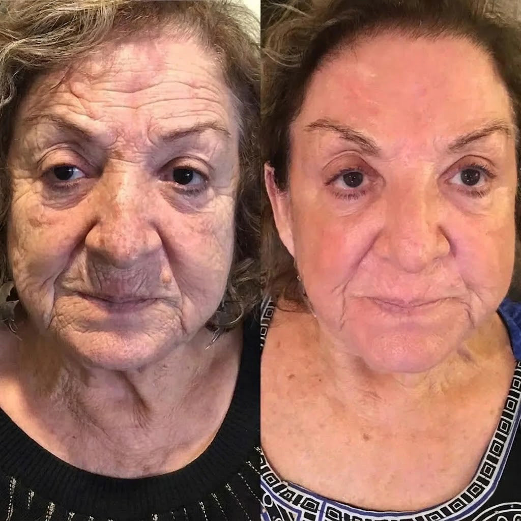 Rolimey®Wrinkle-Lift Tightening cream